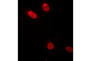 Immunofluorescent analysis of c-Myb staining in HeLa cells. (MYB anticorps  (N-Term))