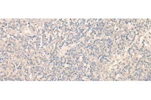 Immunohistochemistry of paraffin-embedded Human tonsil tissue using PITPNB Polyclonal Antibody at dilution of 1:25(x200) (PITPNB anticorps)