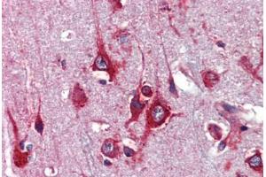 Human Brain, Cortex (formalin-fixed, paraffin-embedded) stained with TFAP2C antibody ABIN462192 followed by biotinylated goat anti-rabbit IgG secondary antibody ABIN481713, alkaline phosphatase-streptavidin and chromogen.
