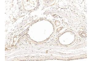 Detection of TUBb in Human Mammary gland Tissue using Polyclonal Antibody to Tubulin Beta (TUBb)