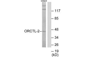 Western Blotting (WB) image for anti-Solute Carrier Family 22 Member 18 (SLC22A18) (C-Term) antibody (ABIN1849893) (ORCTL-2/SLC22A18 anticorps  (C-Term))