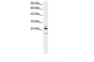 Image no. 2 for anti-Regulator of G-Protein Signaling 20 (RGS20) (AA 127-176) antibody (ABIN202110)