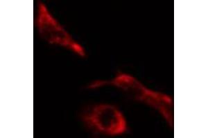ABIN6274623 staining HeLa cells by IF/ICC. (COL5A1 anticorps  (Internal Region))