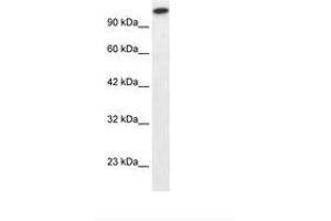 anti-GLI Family Zinc Finger 2 (GLI2) (AA 600-649) antibody