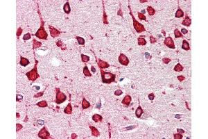 Anti-GALR1 / Galanin Receptor 1 antibody IHC staining of human brain, cortex.