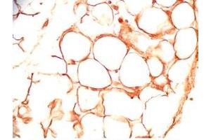 Rat visceral fat tissue was stained by Rabbit Anti-sFRP-2 (25-50) (Human) Antiserum