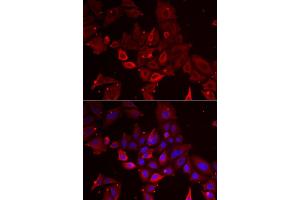Immunofluorescence analysis of U2OS cell using MYOT antibody. (Myotilin anticorps)