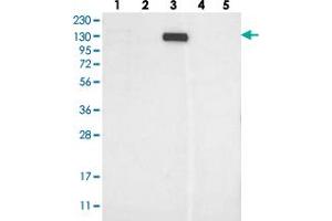 Western blot analysis of Lane 1: RT-4, Lane 2: U-251 MG, Lane 3: Human Plasma, Lane 4: Liver, Lane 5: Tonsil with MKL1 polyclonal antibody  at 1:250-1:500 dilution. (MKL1 anticorps)
