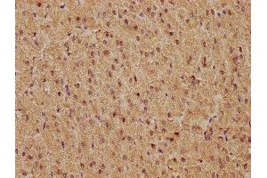 IHC image of ABIN7127496 diluted at 1:81 and staining in paraffin-embedded human adrenal gland tissue performed on a Leica BondTM system.