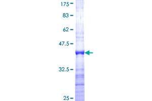 Image no. 1 for Forkhead Box G1 (FOXG1) (AA 183-291) protein (GST tag) (ABIN1354352)
