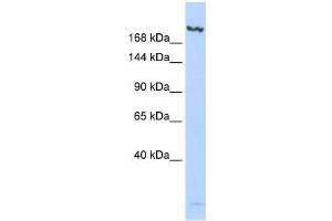 Western Blot showing JMJD3 antibody used at a concentration of 1-2 ug/ml to detect its target protein. (Kdm6b anticorps  (N-Term))