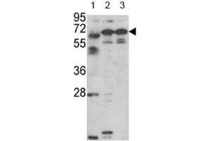 Western blot analysis of Fascin-3 antibody and 1) MDA-MB231, 2) NCI-H460 cell line and 3) mouse testis tissue lysate. (Fascin 3 anticorps  (AA 1-30))