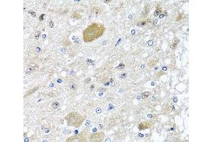 Immunohistochemistry of paraffin-embedded Rat brain using CST1 Polyclonal Antibody at dilution of 1:100 (40x lens). (CST1 anticorps)