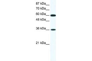 Human Jurkat; WB Suggested Anti-FOXF1 Antibody Titration: 1. (FOXF1 anticorps  (N-Term))