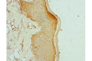 Immunohistochemistry of paraffin-embedded human skin tissue using ABIN7157648 at dilution of 1:100