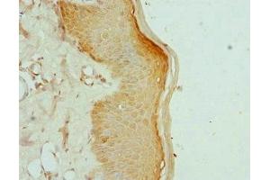 Immunohistochemistry of paraffin-embedded human skin tissue using ABIN7157648 at dilution of 1:100 (KIF2B anticorps  (AA 544-673))