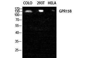 Western Blotting (WB) image for anti-G Protein-Coupled Receptor 158 (GPR158) (N-Term) antibody (ABIN3175351) (GPR158 anticorps  (N-Term))