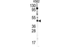 Western Blotting (WB) image for anti-Protein Arginine Methyltransferase 8 (PRMT8) antibody (ABIN2996585) (PRMT8 anticorps)