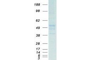 Validation with Western Blot