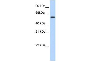 WB Suggested Anti-NKX1-1 Antibody Titration:  1. (NKX1-1 anticorps  (Middle Region))