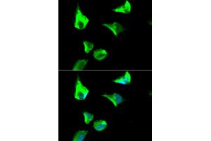 Immunofluorescence analysis of HeLa cell using RRM1 antibody. (RRM1 anticorps)