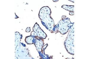 Immunohistochemistry of paraffin-embedded human placenta using MUC1 Rabbit pAb (ABIN6131522, ABIN6144194, ABIN6144195 and ABIN6213810) at dilution of 1:100 (40x lens). (MUC1 anticorps  (AA 1182-1255))