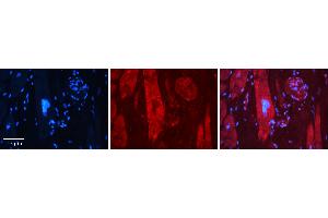 Rabbit Anti-MAP1LC3A Antibody   Formalin Fixed Paraffin Embedded Tissue: Human heart Tissue Observed Staining: Cytoplasmic Primary Antibody Concentration: 1:100 Other Working Concentrations: N/A Secondary Antibody: Donkey anti-Rabbit-Cy3 Secondary Antibody Concentration: 1:200 Magnification: 20X Exposure Time: 0.