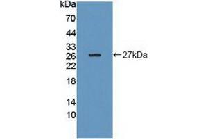 Detection of Recombinant Grb10, Human using Polyclonal Antibody to Growth Factor Receptor Bound Protein 10 (Grb10)