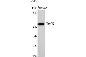 Western Blot analysis of various cells using TrxR2 Polyclonal Antibody.