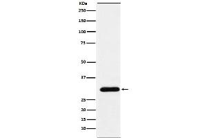 Western blot analysis of GTF2F2 expression in HeLa cell lysate.