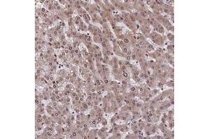 Immunohistochemical staining of human liver with SLC38A7 polyclonal antibody  shows moderate cytoplasmic and nuclear membranous positivity in hepatocytes at 1:200-1:500 dilution. (Solute Carrier Family 38, Member 7 (SLC38A7) anticorps)