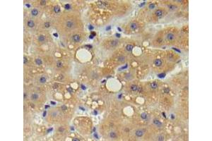 Used in DAB staining on fromalin fixed paraffin-embedded liver tissue (IL17 Receptor B anticorps  (AA 61-200))