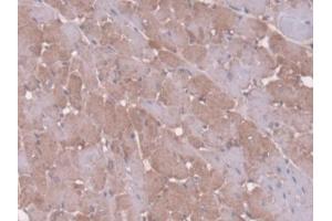 Detection of AT in Rat Heart Tissue using Polyclonal Antibody to Antithrombin (AT)