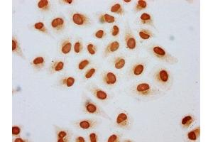 Immunocytochemistry analysis of ABIN7139160 diluted at 1:3 and staining in Hela cells (treated with 30mM sodium butyrate for 4h) performed on a Leica BondTM system.