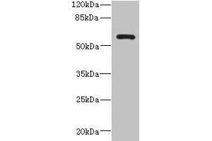 Western blot All lanes: ZCCHC4 antibody at 0. (ZCCHC4 anticorps  (AA 25-229))