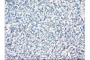 Immunohistochemical staining of paraffin-embedded colon tissue using anti-PPP5Cmouse monoclonal antibody. (PP5 anticorps)