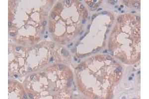 DAB staining on IHC-P; Samples: Human Kidney Tissue
