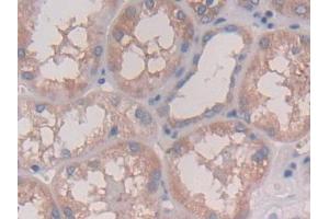DAB staining on IHC-P; Samples: Human Kidney Tissue (IL28A anticorps  (AA 26-200))