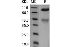 Western Blotting (WB) image for Met Proto-Oncogene (MET) (Active) protein (His tag) (ABIN7196994)