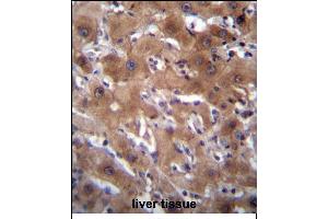 RASSF10 Antibody (Center) (ABIN656377 and ABIN2845672) immunohistochemistry analysis in formalin fixed and paraffin embedded human liver tissue followed by peroxidase conjugation of the secondary antibody and DAB staining. (RASSF10 anticorps  (AA 230-259))