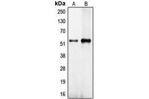 Western blot analysis of CEP57 expression in NT2D1 (A), HeLa (B) whole cell lysates. (CEP57 anticorps  (Center))