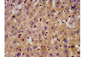 IHC image of ABIN7143948 diluted at 1:300 and staining in paraffin-embedded human liver tissue performed on a Leica BondTM system. (Chromosome 6 Open Reading Frame 134 (C6orf134) (AA 194-238) anticorps)