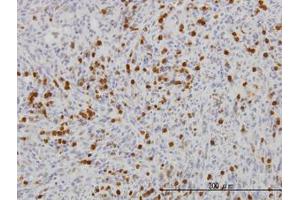 Image no. 2 for anti-Gardner-Rasheed Feline Sarcoma Viral (V-Fgr) Oncogene Homolog (FGR) (AA 1-90) antibody (ABIN598685) (Fgr anticorps  (AA 1-90))