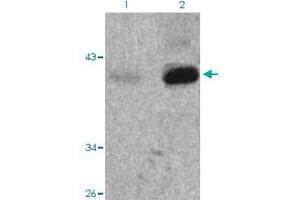 Western blot analysis of Lane 1: 293 cells, Lane 2: TNF treated 293 cells with Nfkbie (phospho S22) polyclonal antibody  at 1:500-1:1000 dilution. (NFKBIE anticorps  (pSer22))