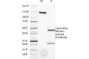 SDS-PAGE Analysis Purified IFNA1 Mouse Monoclonal Antibody (2-52).