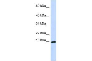 WB Suggested Anti-CXCL9 Antibody Titration:  0. (CXCL9 anticorps  (Middle Region))