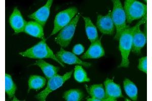 IF analysis of PI 3 Kinase p85 alpha/PIK3R1 using anti-PI 3 Kinase p85 alpha/PIK3R1 antibody (ABIN7599781). (PIK3R1 anticorps  (AA 117-153))