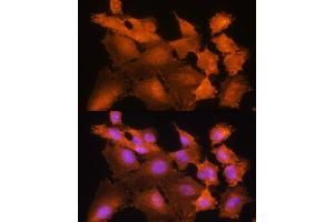 Immunofluorescence analysis of C6 cells using ADK Rabbit pAb  at dilution of 1:100.