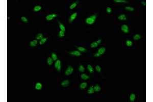 Immunofluorescence staining of Hela cells with ABIN7139615 at 1:2.