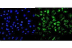 IF analysis of Mesp2 using anti-Mesp2 antibody (ABIN7599353).